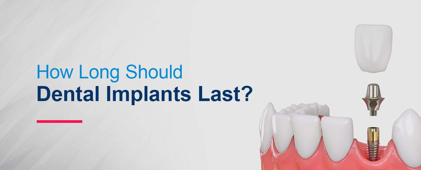 dental implant lifespan