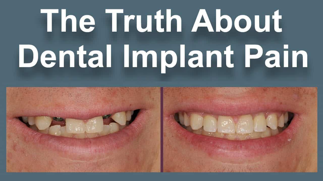 dental implant paintful